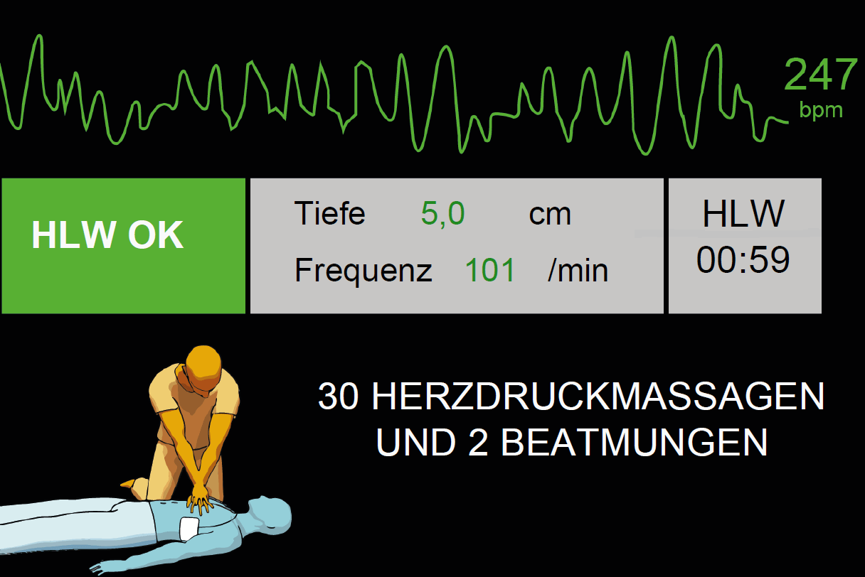 Defibrillator mit EKG-Ansicht
